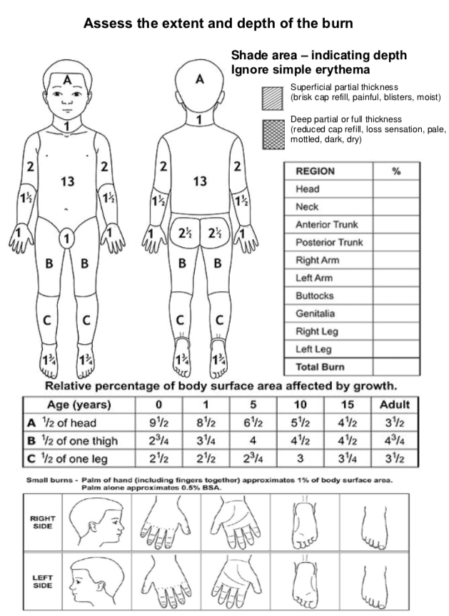 TBSA diagram